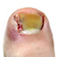 Toe
