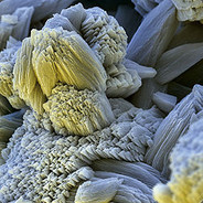 H5N1