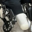 Big Ballas Amputated Leg