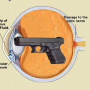 Glockoma