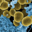 Staphylococcus aureus#casta