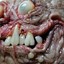 Teratoma °_0