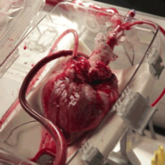 Angiotensin