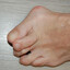 hallux