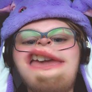 ุ