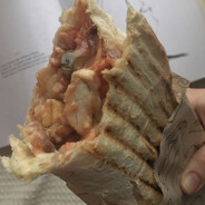siffilis
