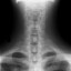 Cervical AP