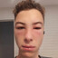 mesi