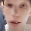 P E E K overdosed??