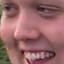 Collin "Bubble Butt" Klug
