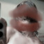 Meq ⑆
