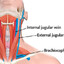 charlie kirks jugular vein