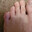 toe stubber
