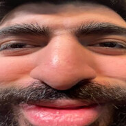 fat hairy turk