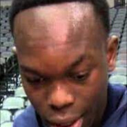 Da Hairline