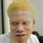 Albino Ginger