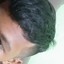 Restoe-