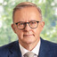 Avatar of Anthony Albanese