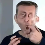 别拿你的发际线对着我