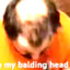 My Balding Head