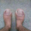 It Hurts When IP