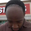 Jidion&#039;s Forehead