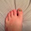 Toe