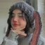 -apnoe