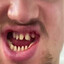 FUCKED UP TEETH