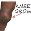 Knee Grow