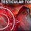 Testicular Torsion