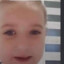 AnalnyRozwieracz