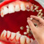 TEETH FELL OUT