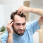 Receding hairline