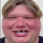 *s1mple*