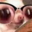 B)