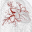 Coronary Angiogram