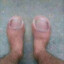 Toe