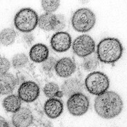 xantavirus