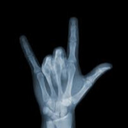 X-Ray