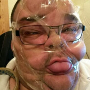 Бедро сухумский