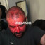 DEMMO