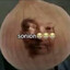 sonion bob