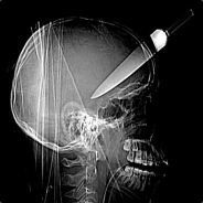 LtBurt[LG] - steam id 76561197971004659