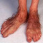 hairy hobbit toes