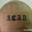 A.C.A.B