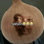 sonion