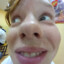babl kvaser