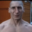 пупковая грыжа не