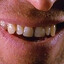 Willem Dafoes' Teeth